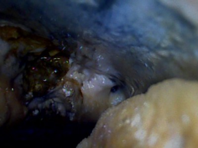 トイレ 排水管内 汚物 付着 修繕内 トラブラン